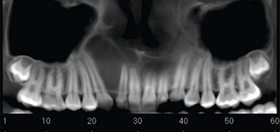 noticia importancia da tomografia da neox radiologia digital odontologica odontologia uberaba