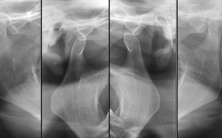 exame atm na neox radiologia digital odontologica odontologia uberaba