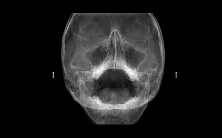exame seios da face na neox radiologia digital odontologica odontologia uberaba